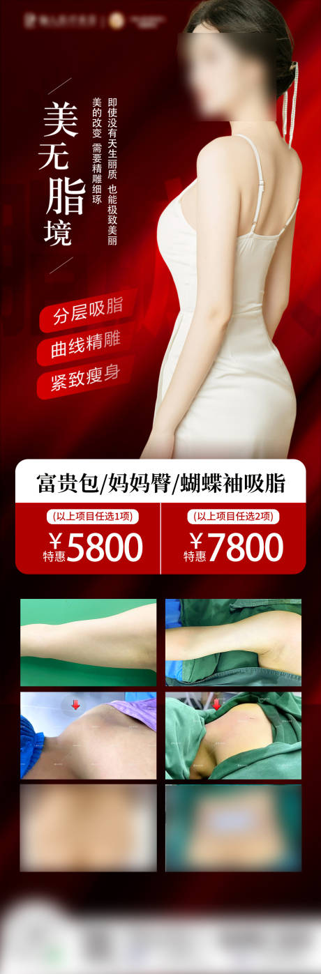 源文件下载【吸脂案例海报】编号：86970024803372313
