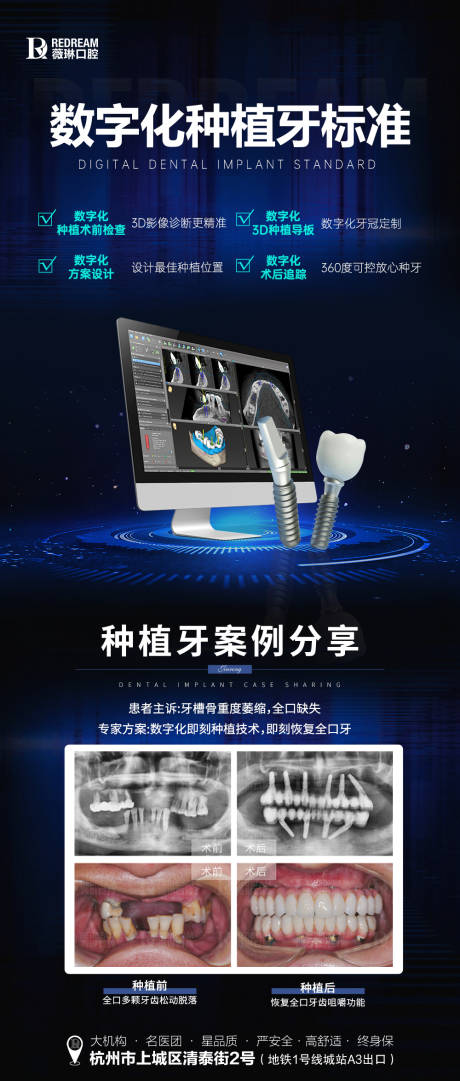源文件下载【享设计】搜索编号：35830025428864192【数字化种植牙】