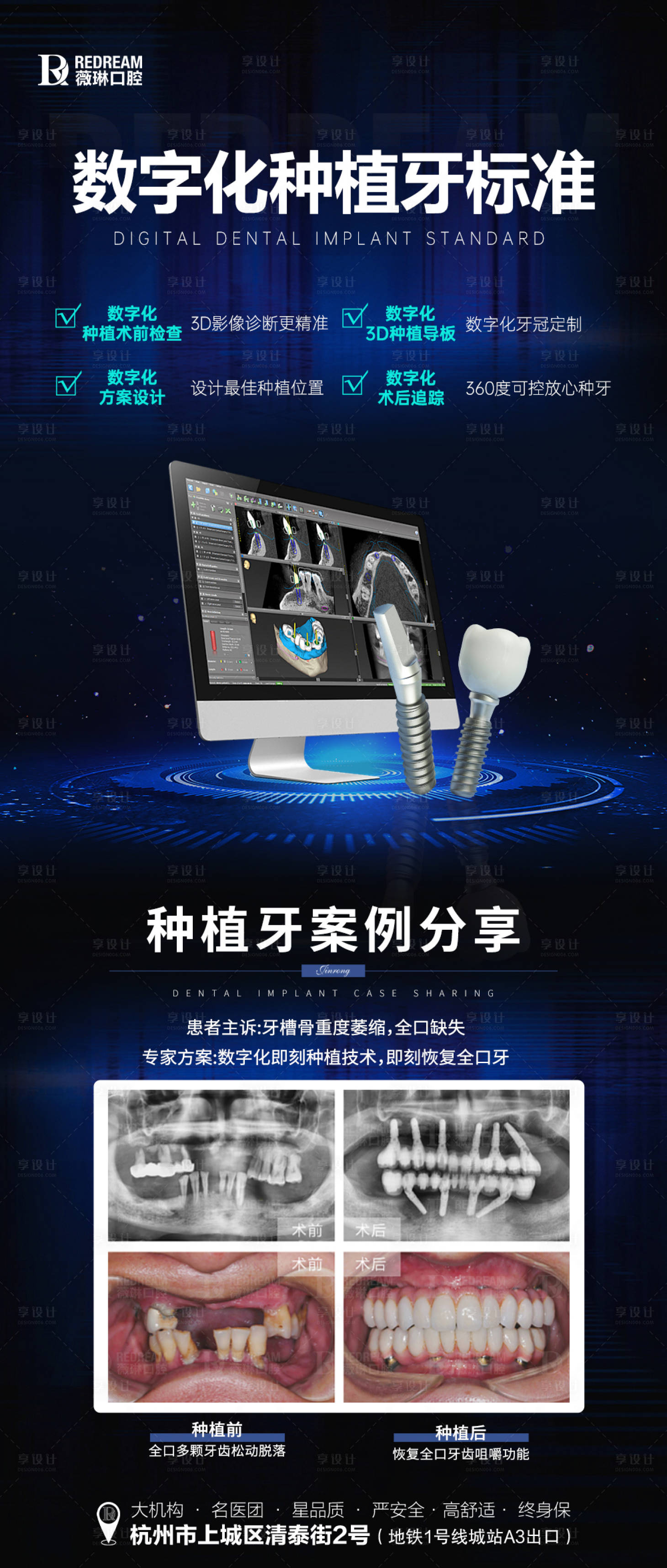 源文件下載【享設(shè)計(jì)】搜索編號(hào)：35830025428864192【數(shù)字化種植牙】