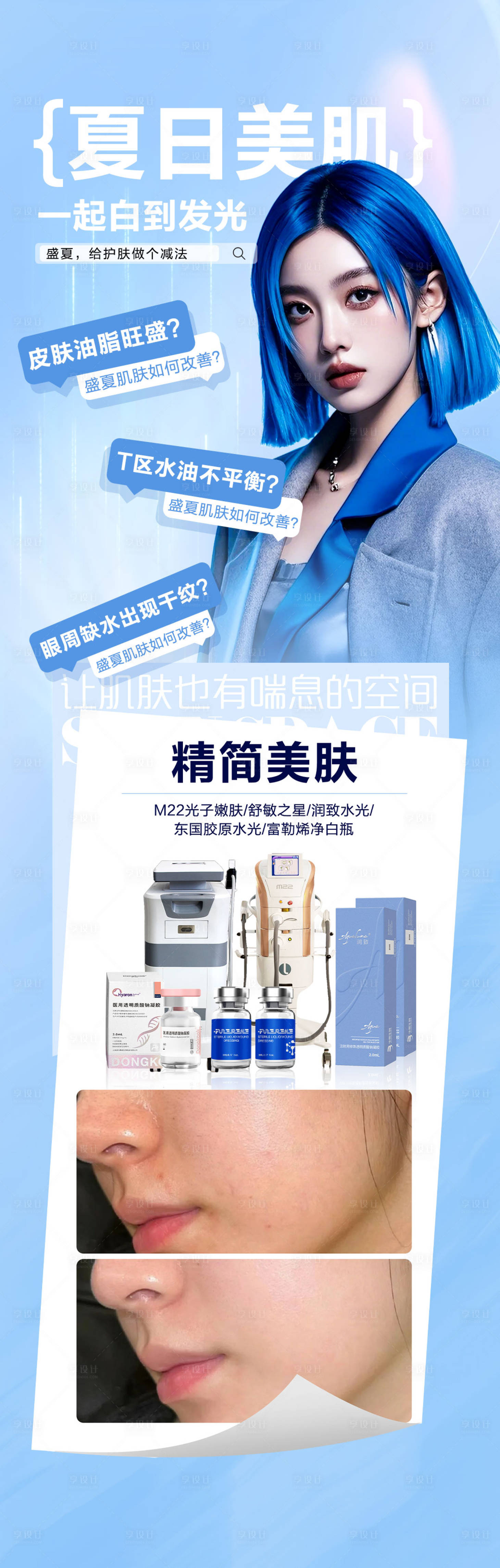 源文件下載【享設(shè)計】搜索編號：98590025380041316【醫(yī)美夏日美膚長圖海報】