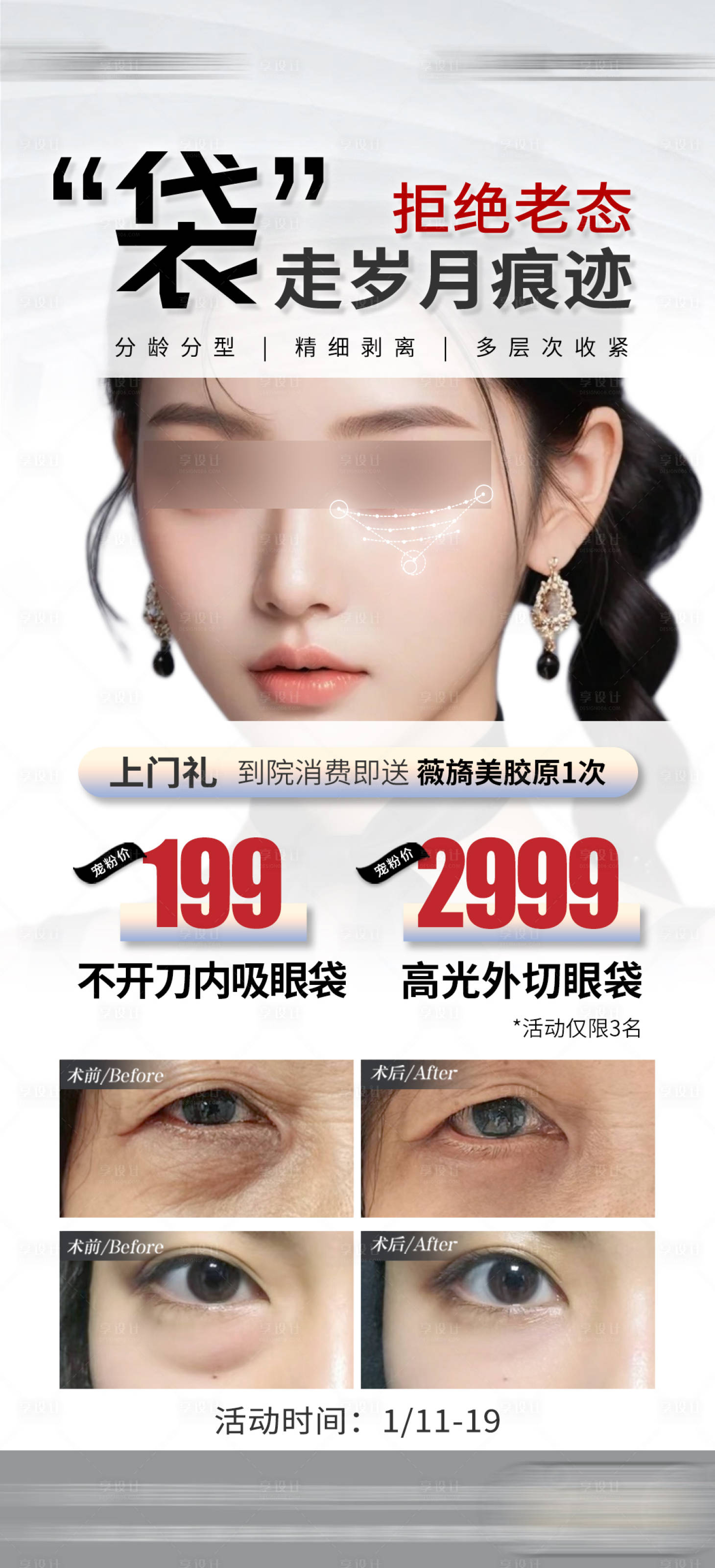 源文件下载【医美整形祛眼袋】编号：24790025367564758