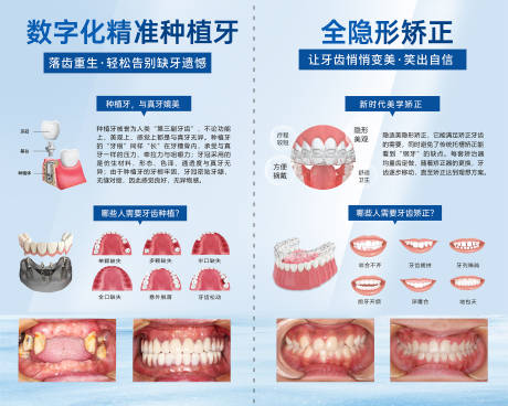 源文件下载【牙齿种植矫正商超宣传海报广告展架】编号：12390025116773143