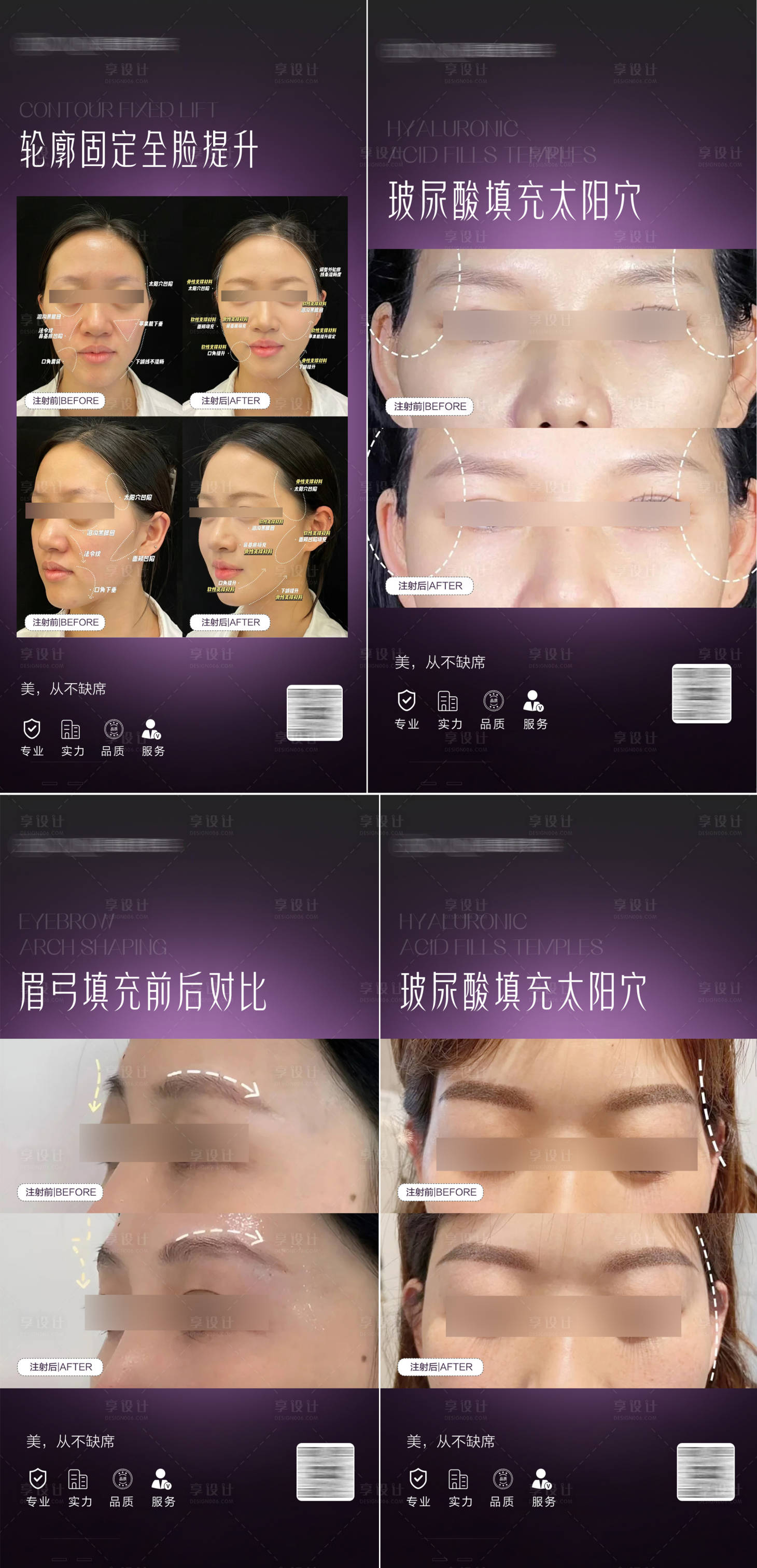源文件下载【医美案例对比海报】编号：56980025611239947