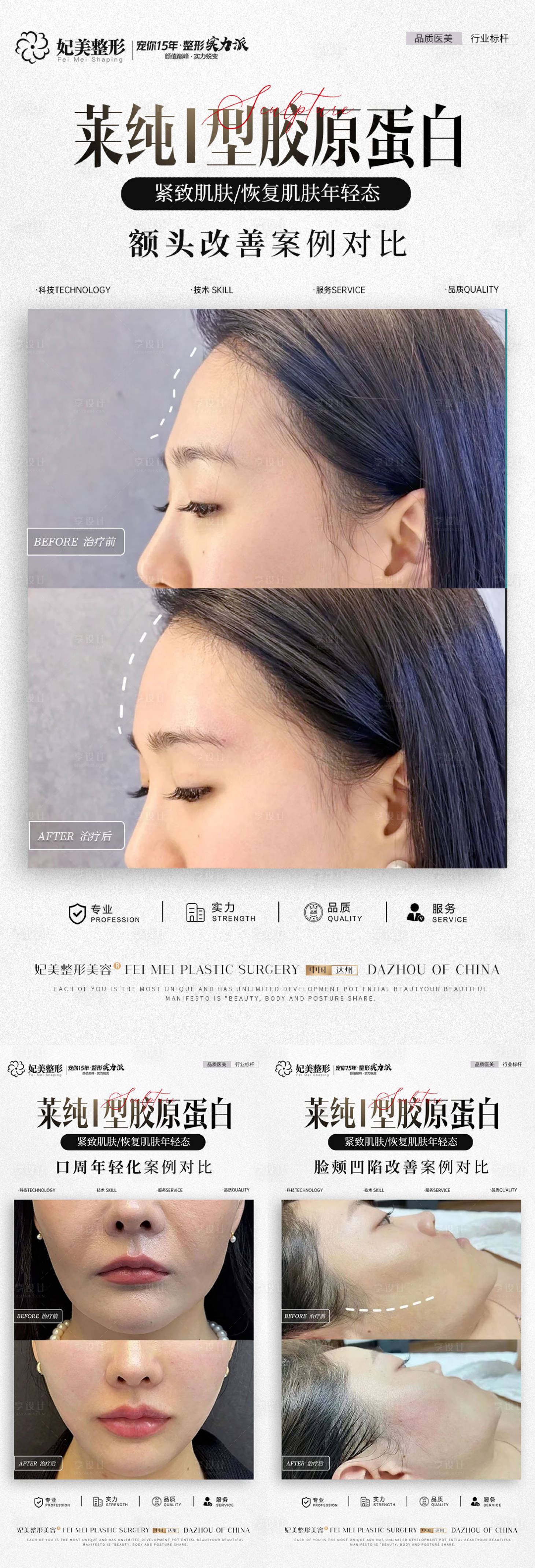 源文件下载【享设计】搜索编号：97910025967988954【医美胶原蛋白案例海报】
