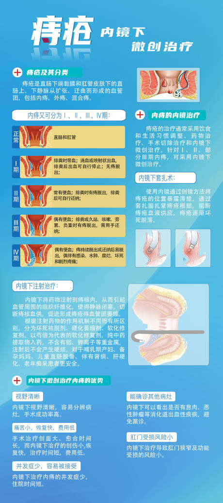 源文件下载【痔疮内镜治疗微创海报】编号：11700025685829120