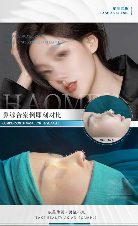 源文件下載【享設計】搜索編號：37530025602363568【醫美案例對比圖】