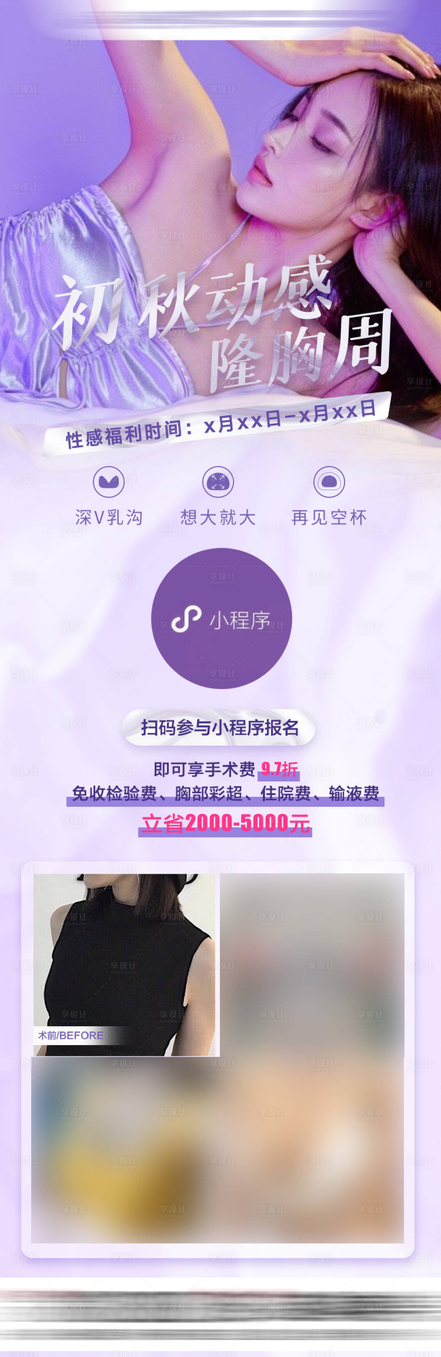 源文件下載【享設計】搜索編號：39190025613938265【醫美隆胸案例招募】
