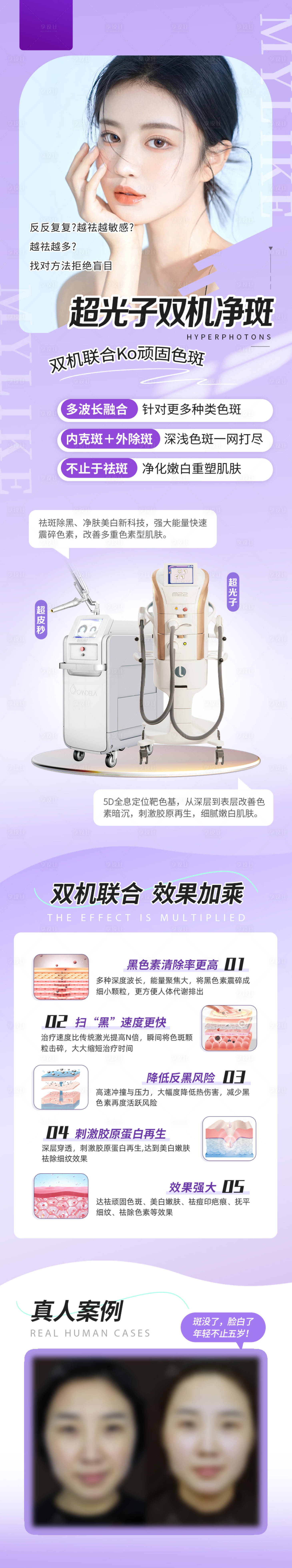 源文件下载【皮肤科双机净斑产品长图】编号：91000025678156366