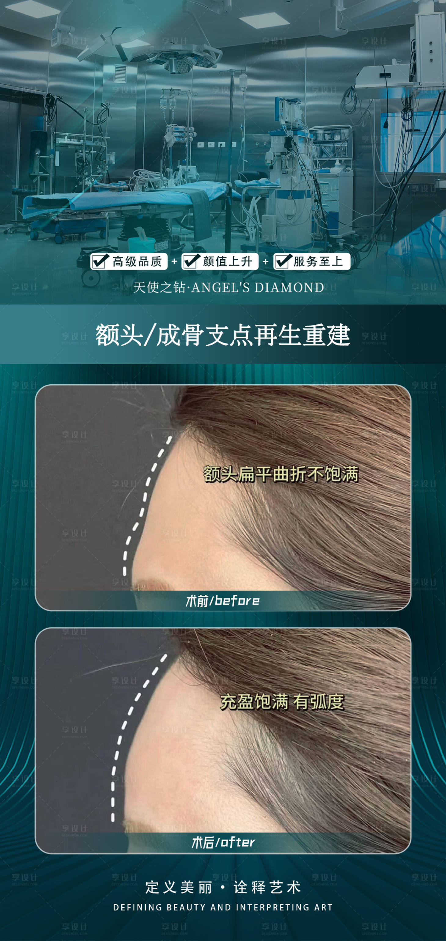 源文件下载【享设计】搜索编号：47060025857053157【医美额头整形案例】