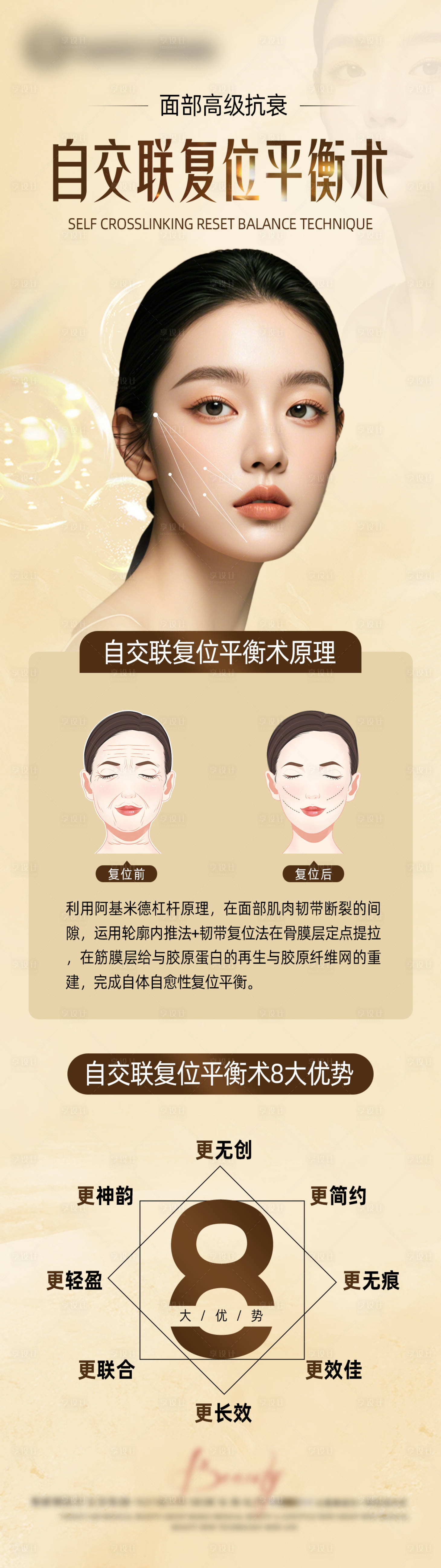 源文件下载【享设计】搜索编号：10630025752237262【自交联复位平衡术】