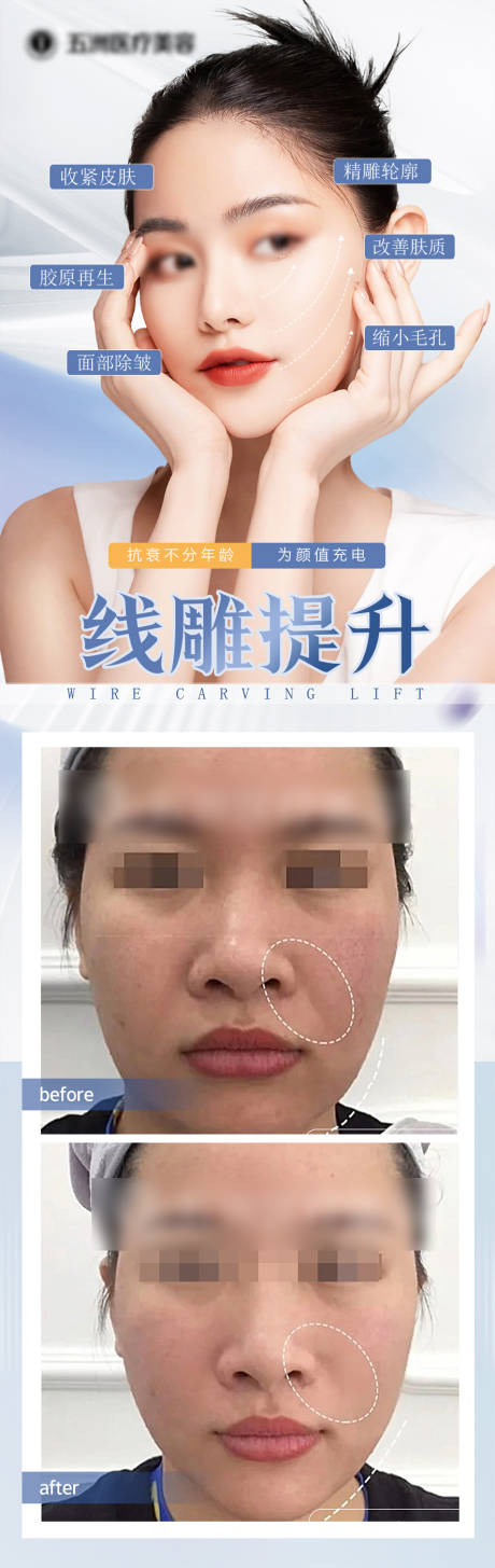 源文件下載【享設計】搜索編號：53970025827475596【醫美線雕抗衰】