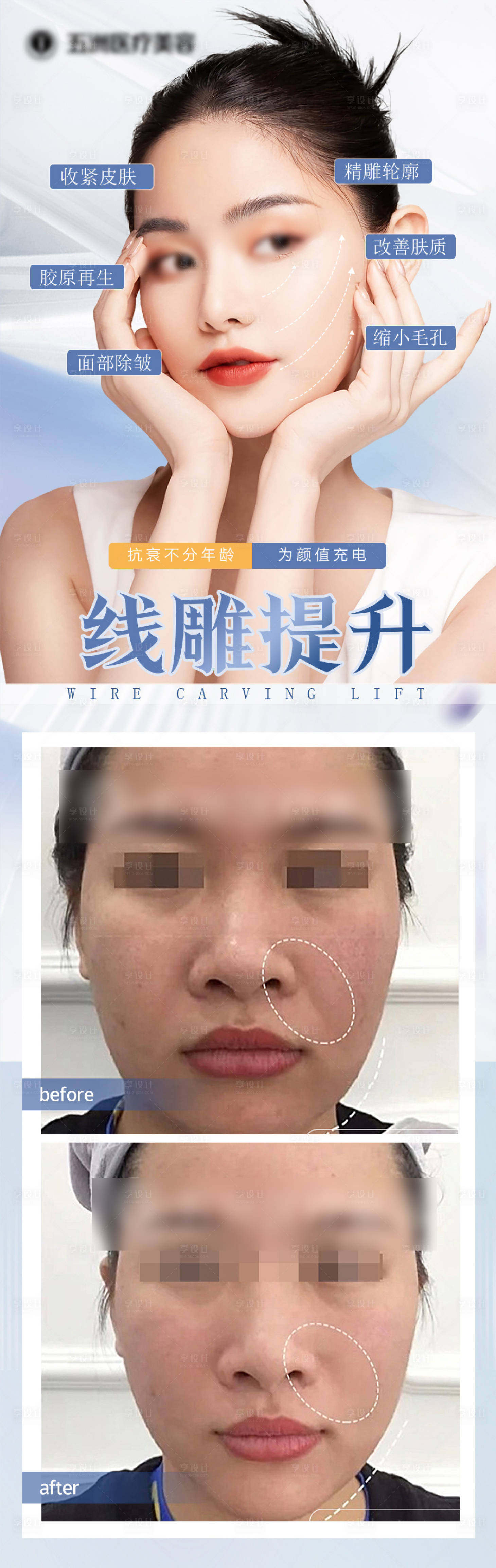 源文件下载【医美线雕抗衰】编号：53970025827475596