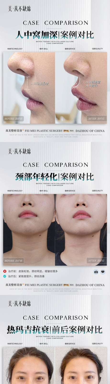 源文件下载【享设计】搜索编号：91960025899353442【美业案例对比系列海报】