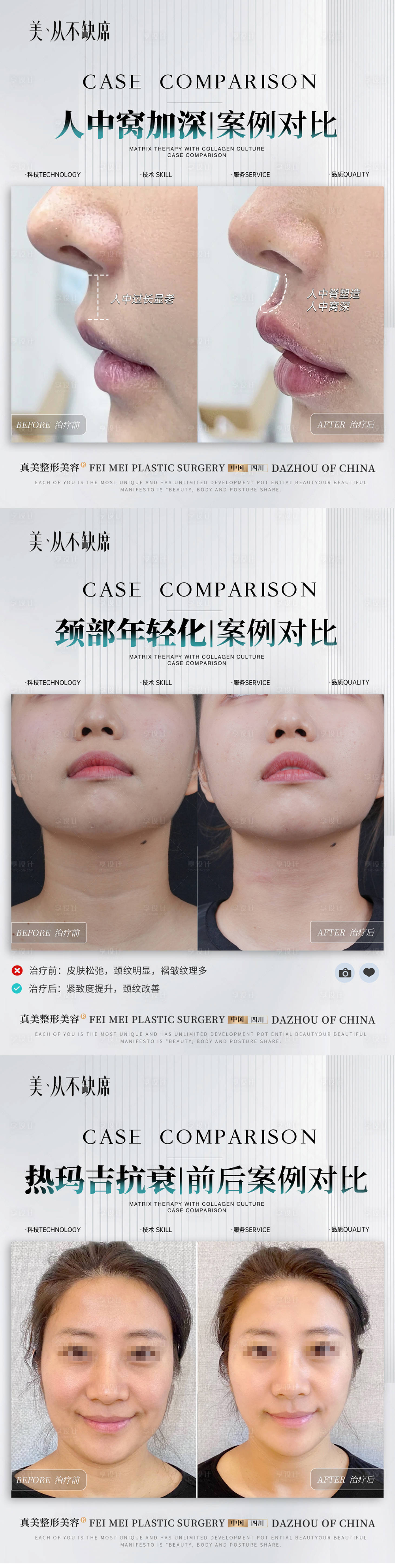 源文件下載【享設計】搜索編號：91960025899353442【美業案例對比系列海報】