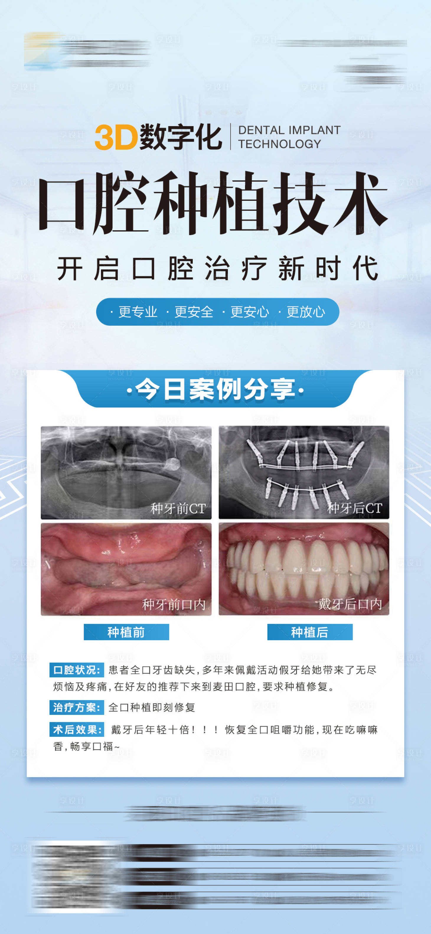 源文件下載【享設(shè)計】搜索編號：82310025547001889【醫(yī)美口腔種植牙案例對比海報】