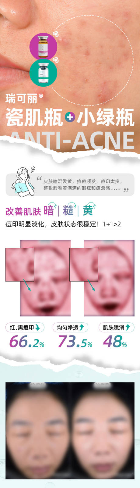 源文件下載【享設計】搜索編號：80860025895284287【瑞可麗瓷肌瓶小綠瓶長圖】