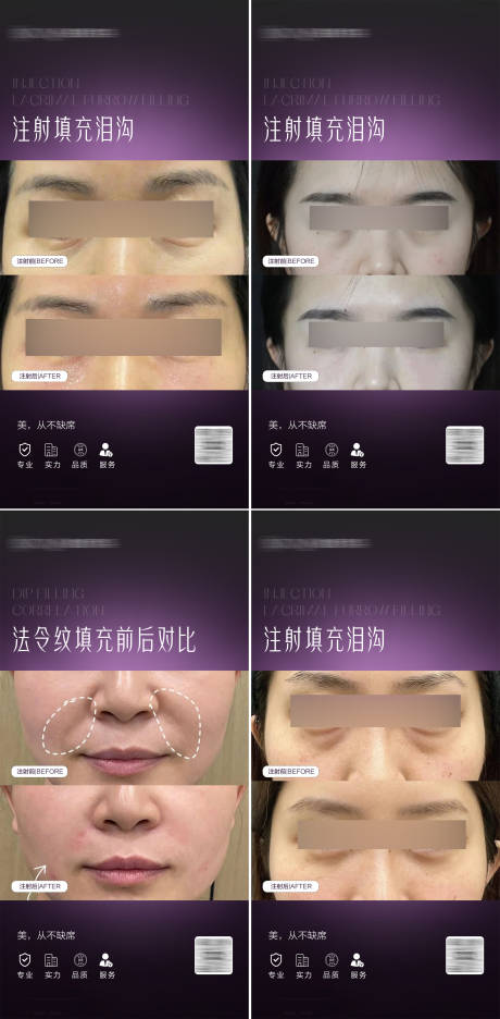 源文件下载【医美泪沟法令纹案例对比海报】编号：27200025576655843