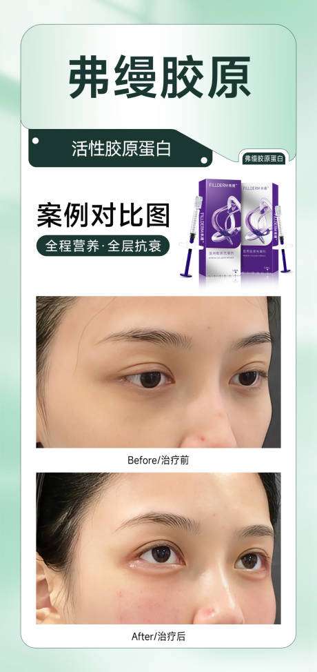 源文件下載【享設(shè)計(jì)】搜索編號：34200025604734078【醫(yī)美案例海報(bào)】