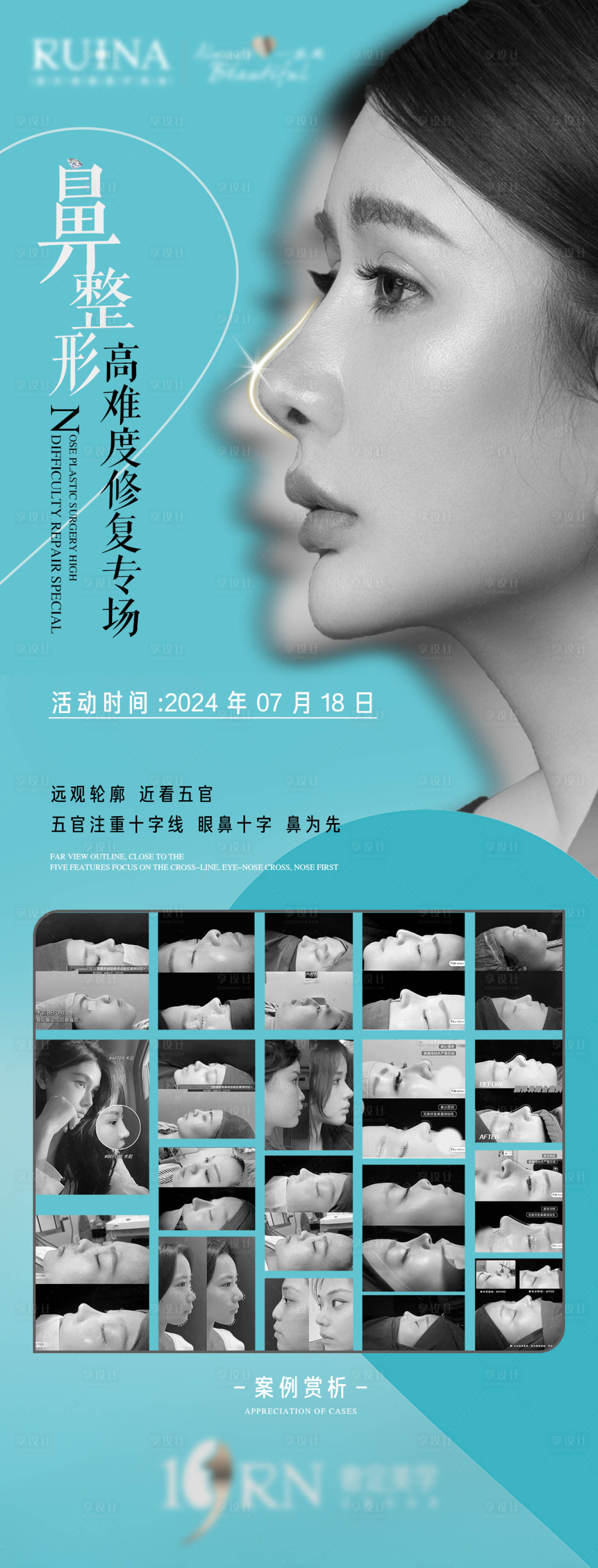 源文件下載【享設(shè)計(jì)】搜索編號(hào)：29040025799149182【高難度鼻整形修復(fù)】