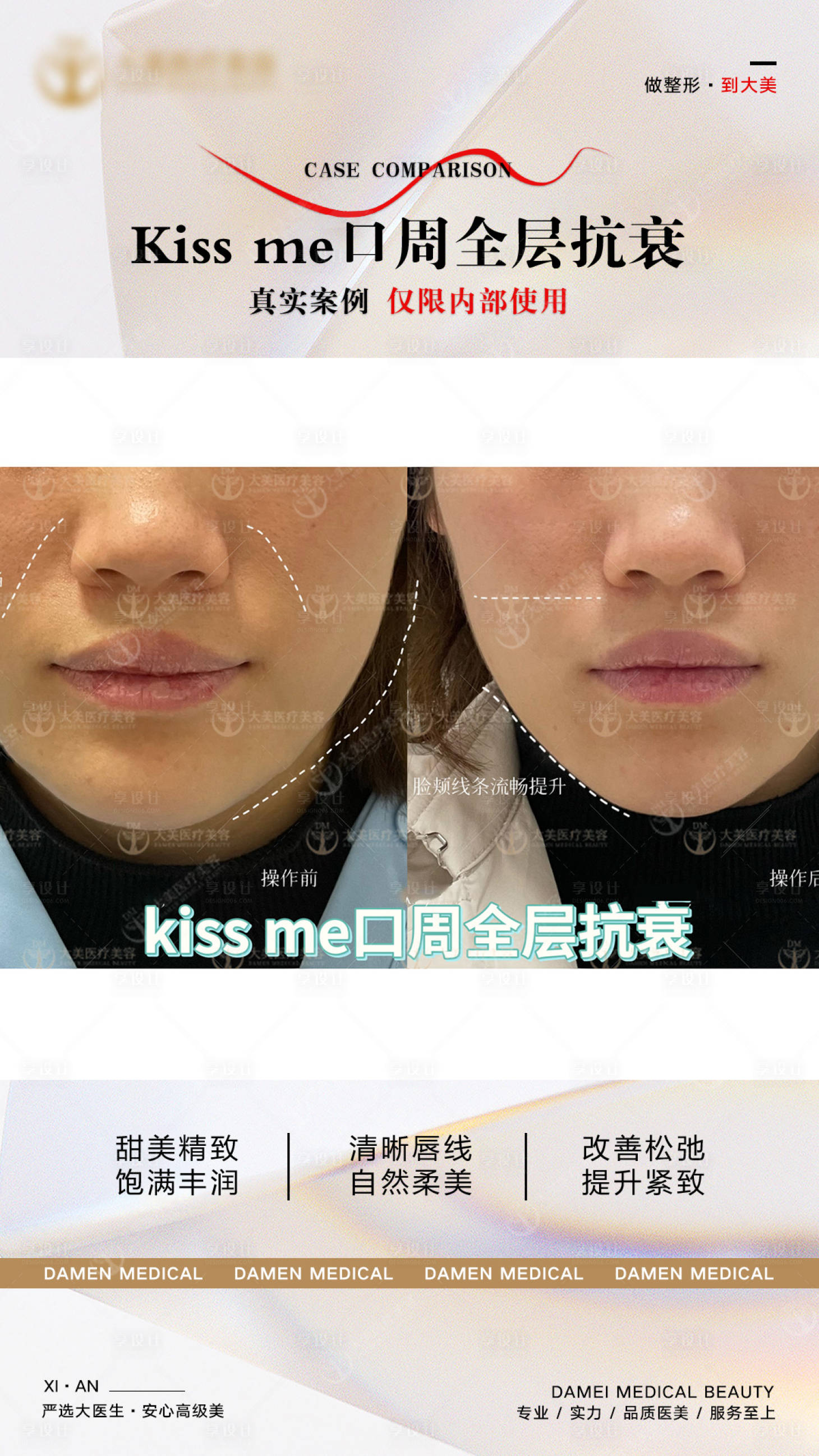 源文件下載【享設計】搜索編號：69820025516202817【醫美案例分析海報】