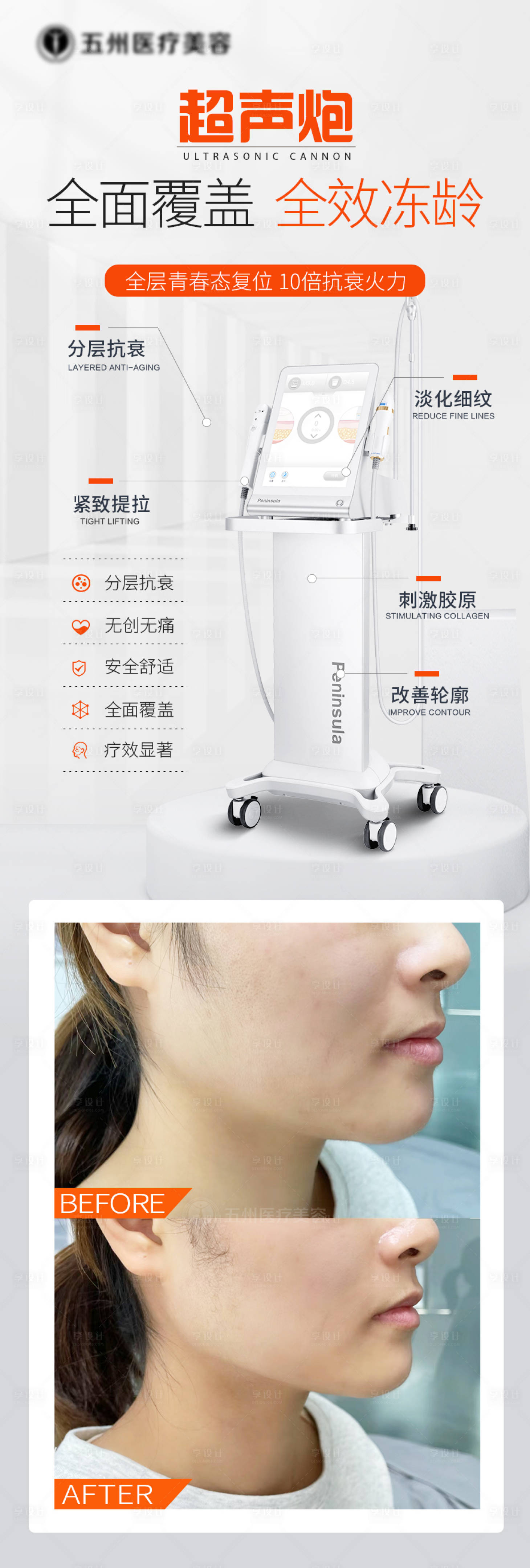 源文件下載【享設計】搜索編號：40810025978195731【醫美超聲炮長圖海報】