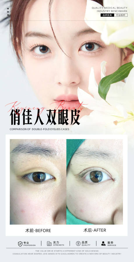 源文件下載【享設計】搜索編號：57420025868567408【雙眼皮案例海報】