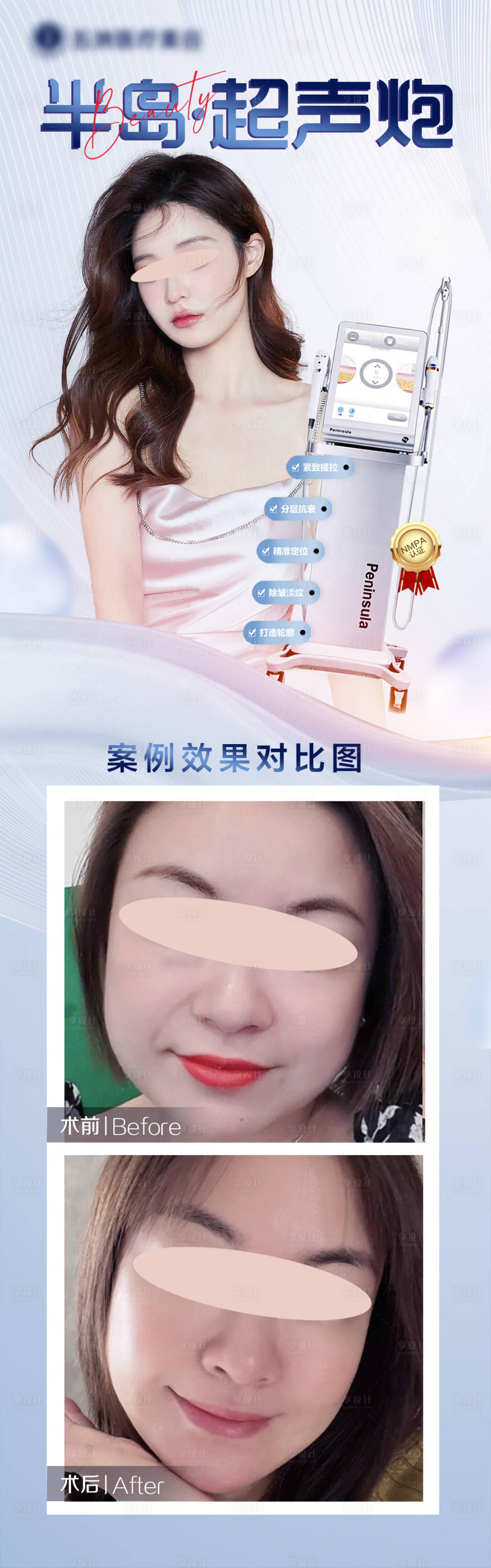 源文件下載【超聲炮案例海報(bào)】編號(hào)：60460025761853527