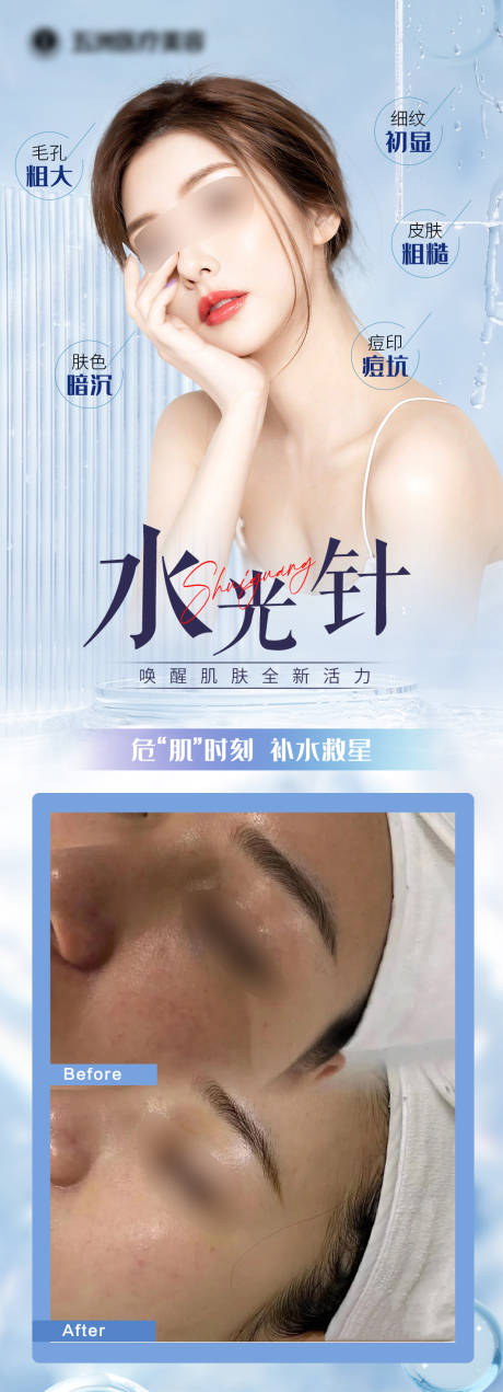 源文件下载【享设计】搜索编号：27680025827369761【医美水光针】