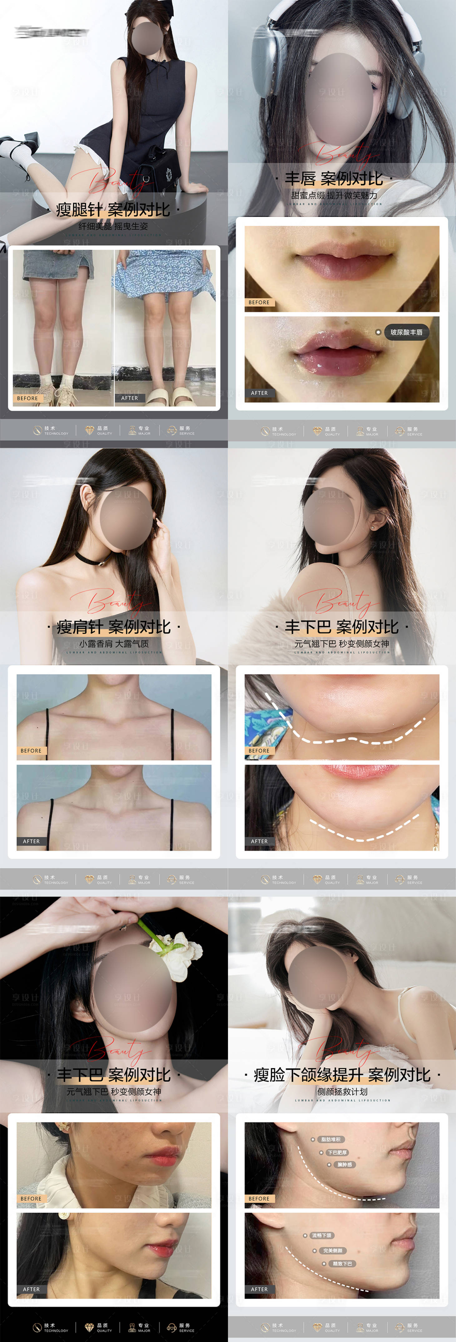 源文件下載【享設計】搜索編號：15080025951576560【醫美案例對比海報】