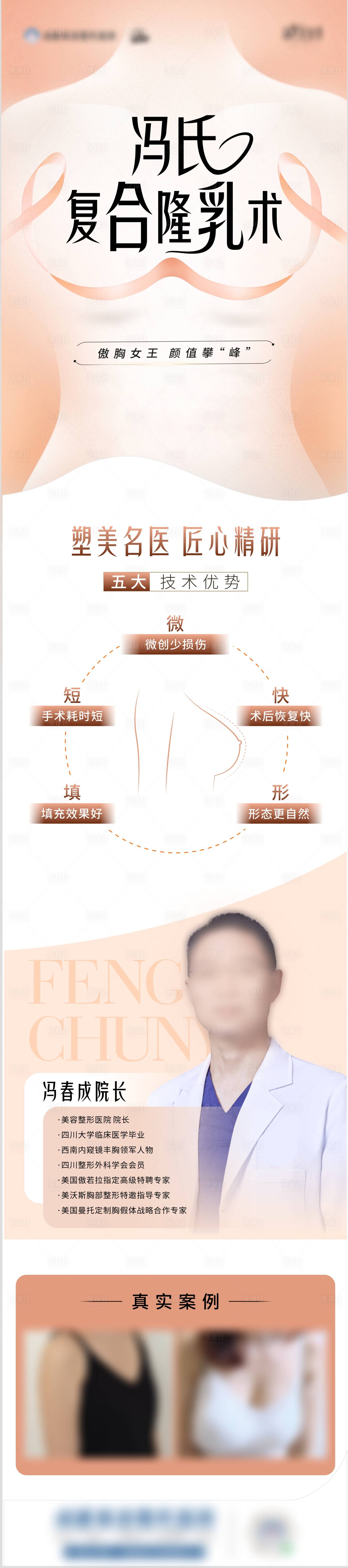 源文件下載【隆胸】編號：42570025726635439