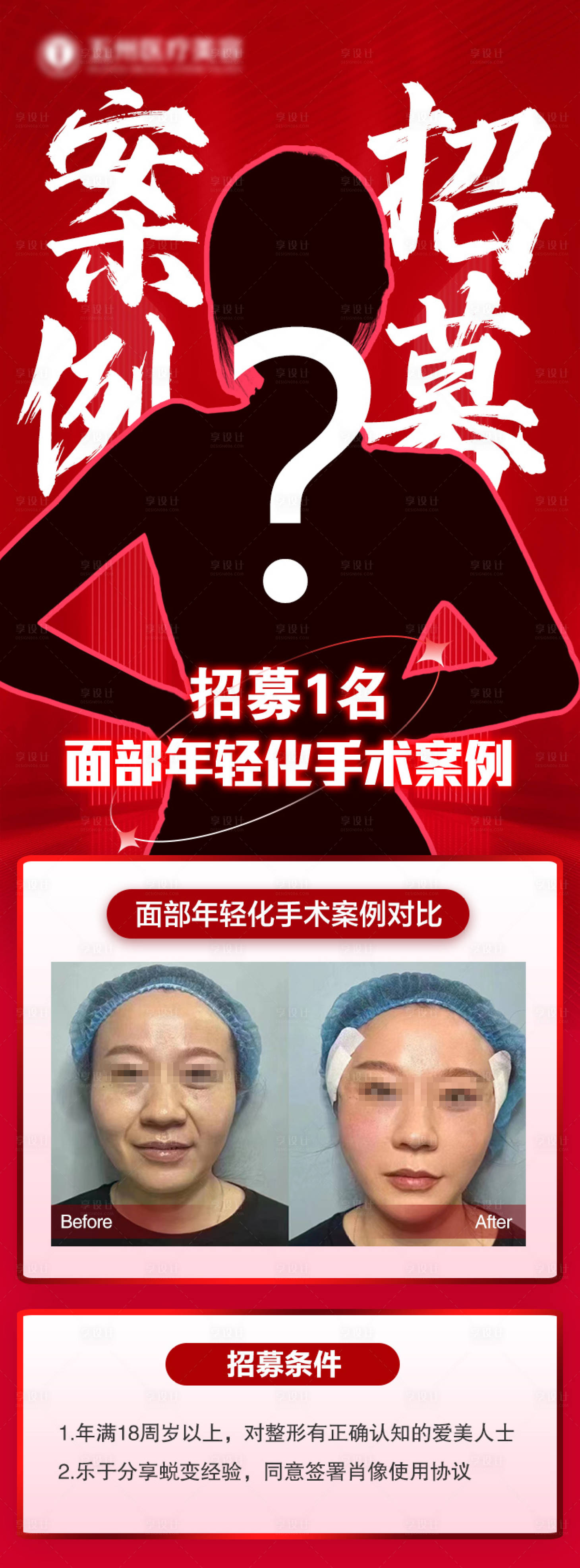 源文件下載【享設計】搜索編號：70360025761839703【醫美案例招募海報】