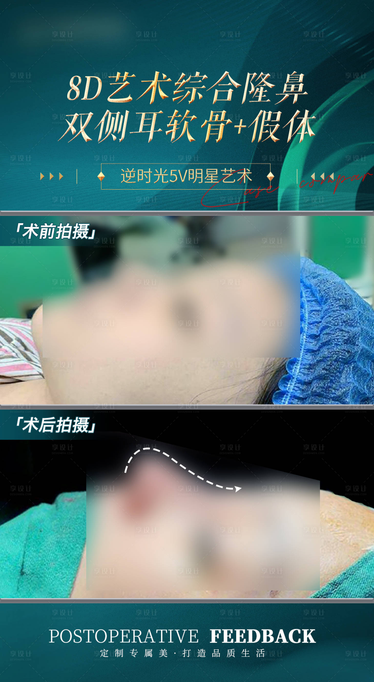 源文件下载【医美鼻子整形案例宣传海报】编号：23820025856739173