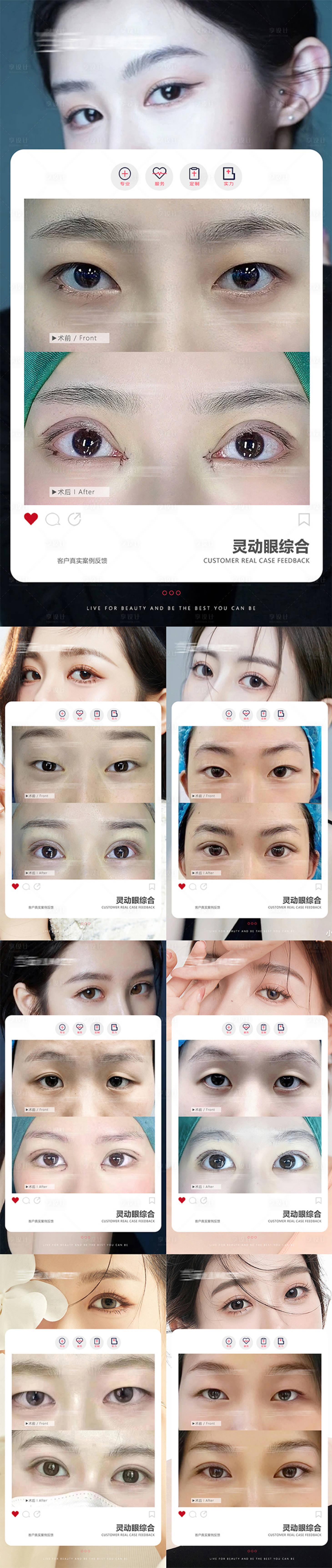 源文件下載【享設計】搜索編號：37770025952484020【眼睛案例】