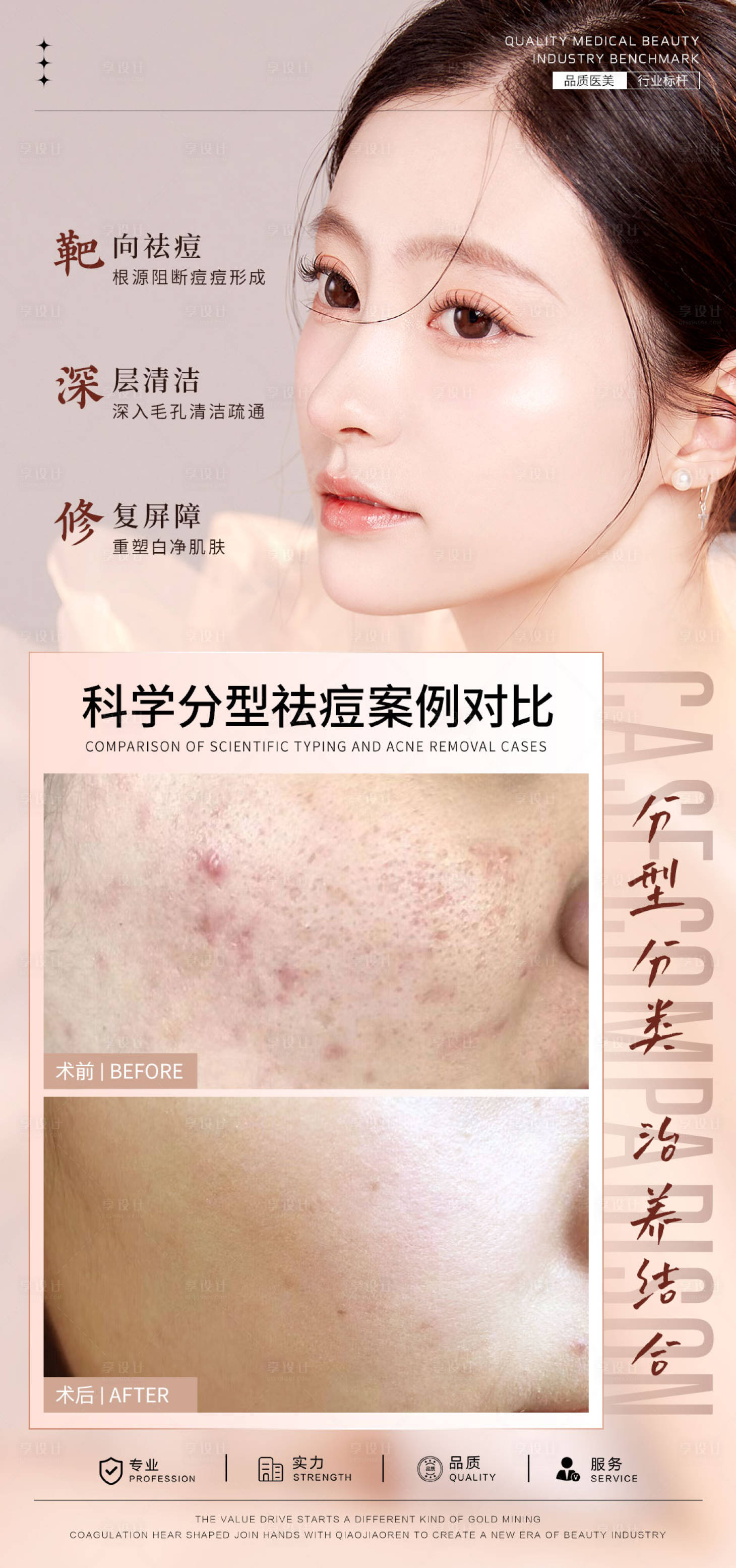 源文件下載【享設(shè)計(jì)】搜索編號(hào)：40520025719286782【祛痘案例對(duì)比海報(bào)】