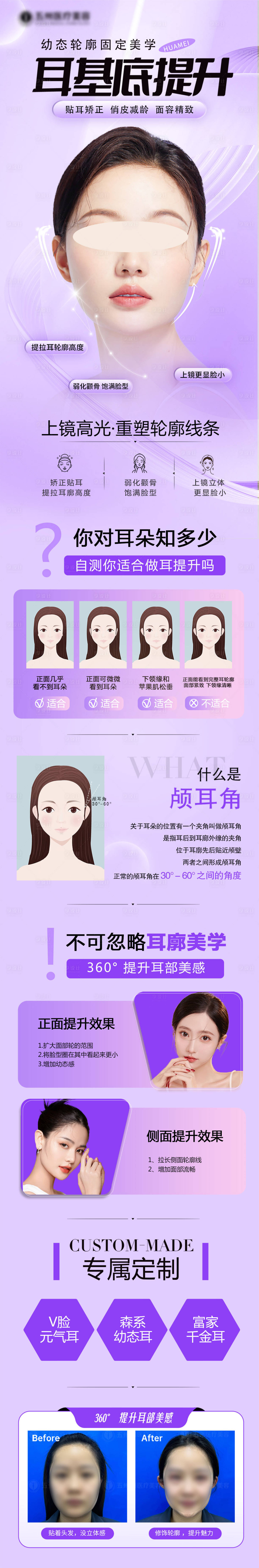 源文件下載【享設(shè)計(jì)】搜索編號(hào)：68880025765039369【醫(yī)美幼態(tài)耳】
