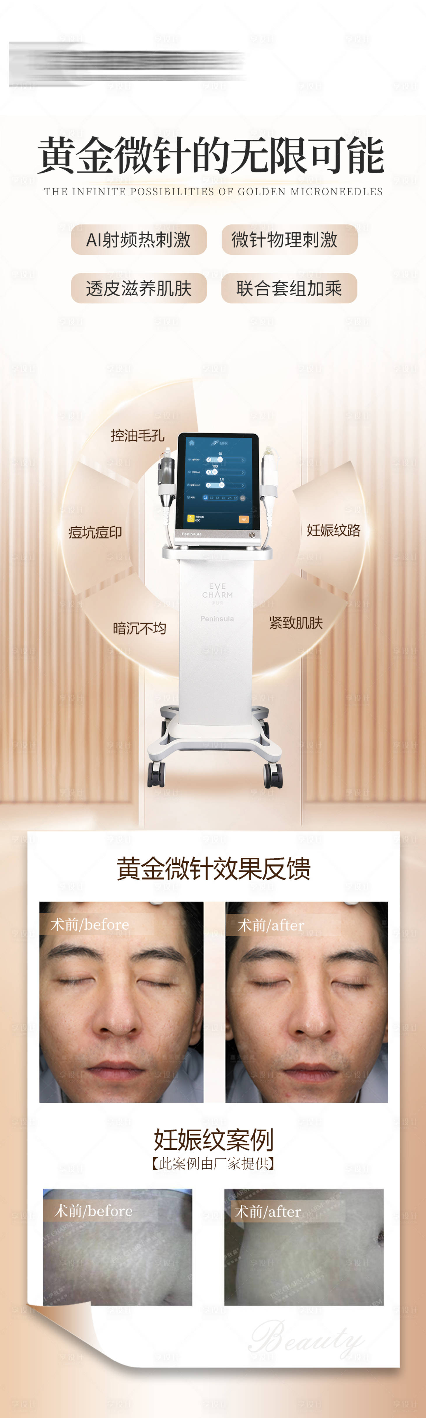 源文件下载【享设计】搜索编号：28990025636134437【黄金微针仪器宣传海报】