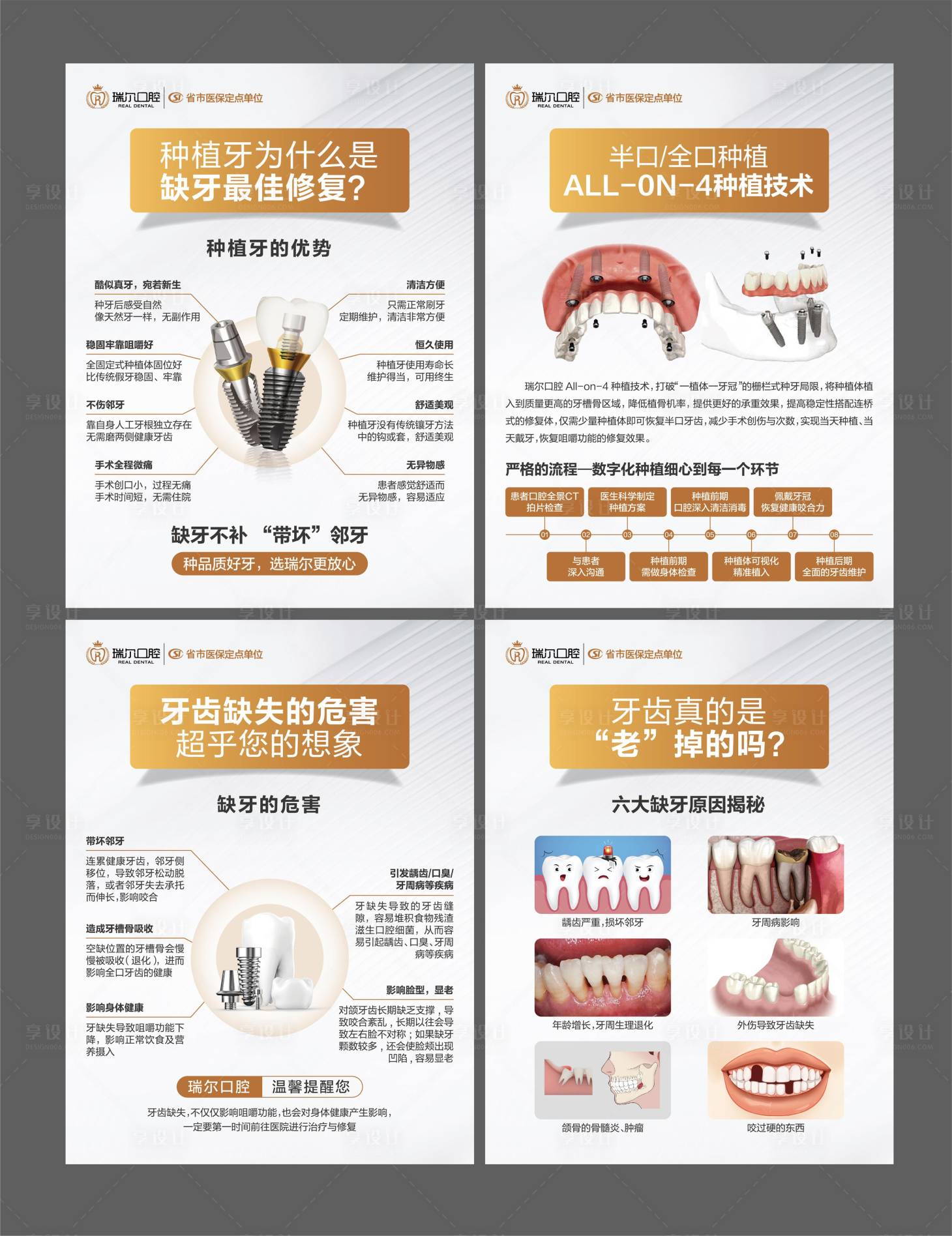 源文件下载【口腔院内物料之种植牙科普海报】编号：69000025930728988