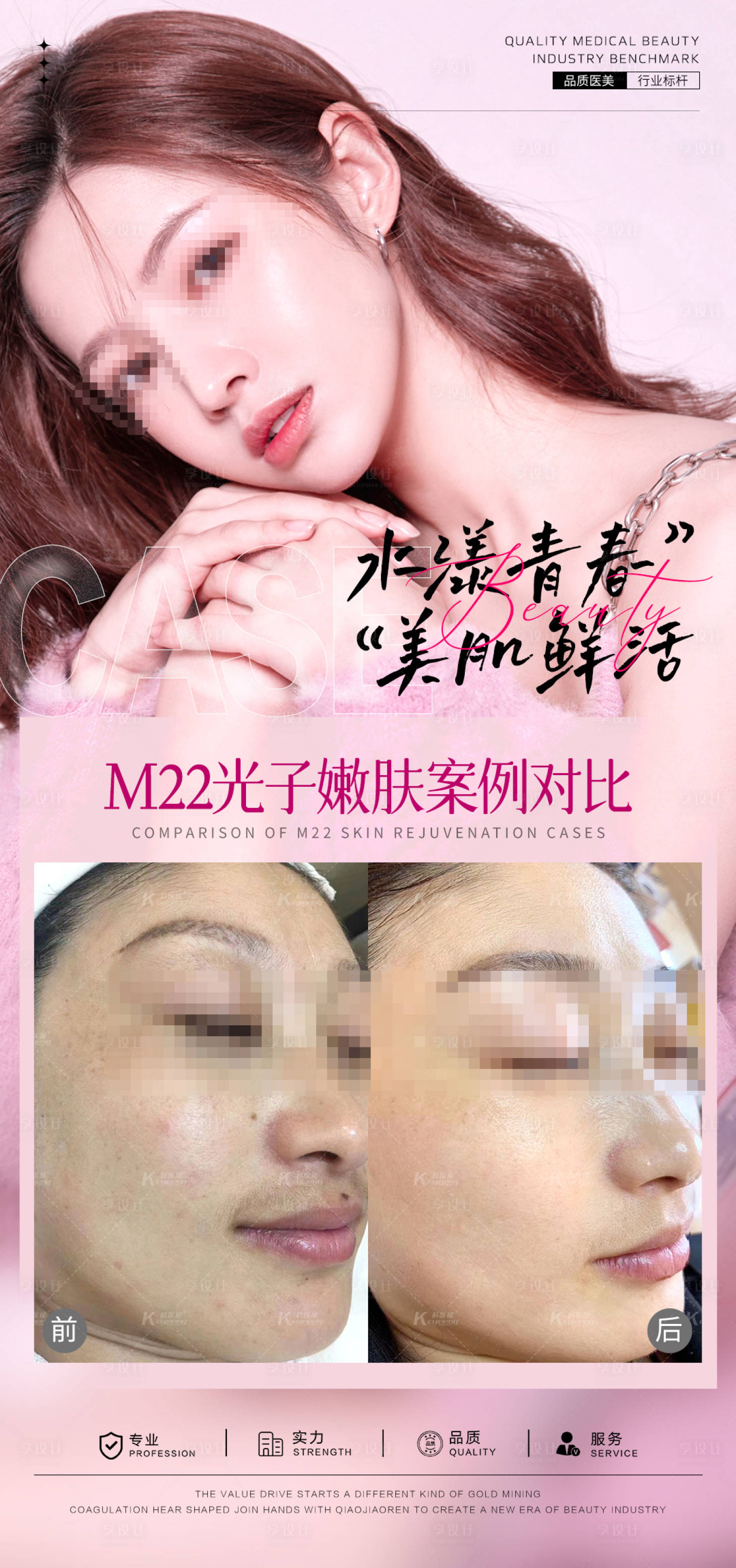 源文件下載【享設計】搜索編號：58100025719261398【光子嫩膚案例對比海報】