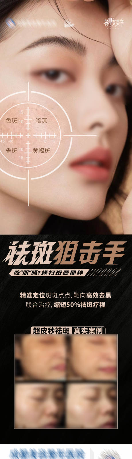源文件下載【享設計】搜索編號：40950025590388822【祛斑狙擊手案例創意海報】