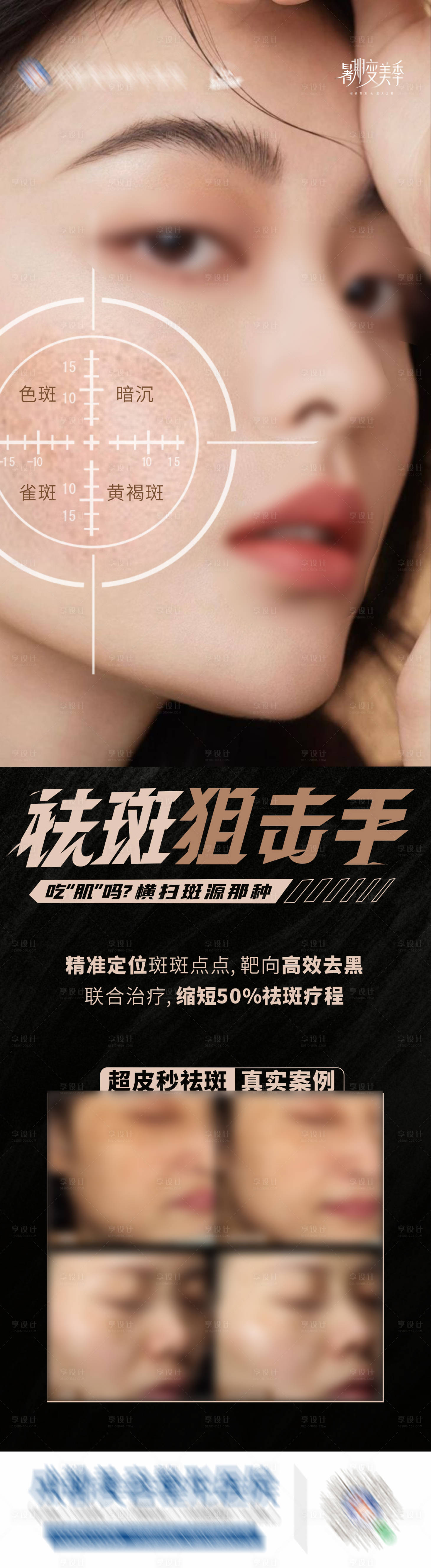 源文件下載【享設(shè)計】搜索編號：40950025590388822【祛斑狙擊手案例創(chuàng)意海報】