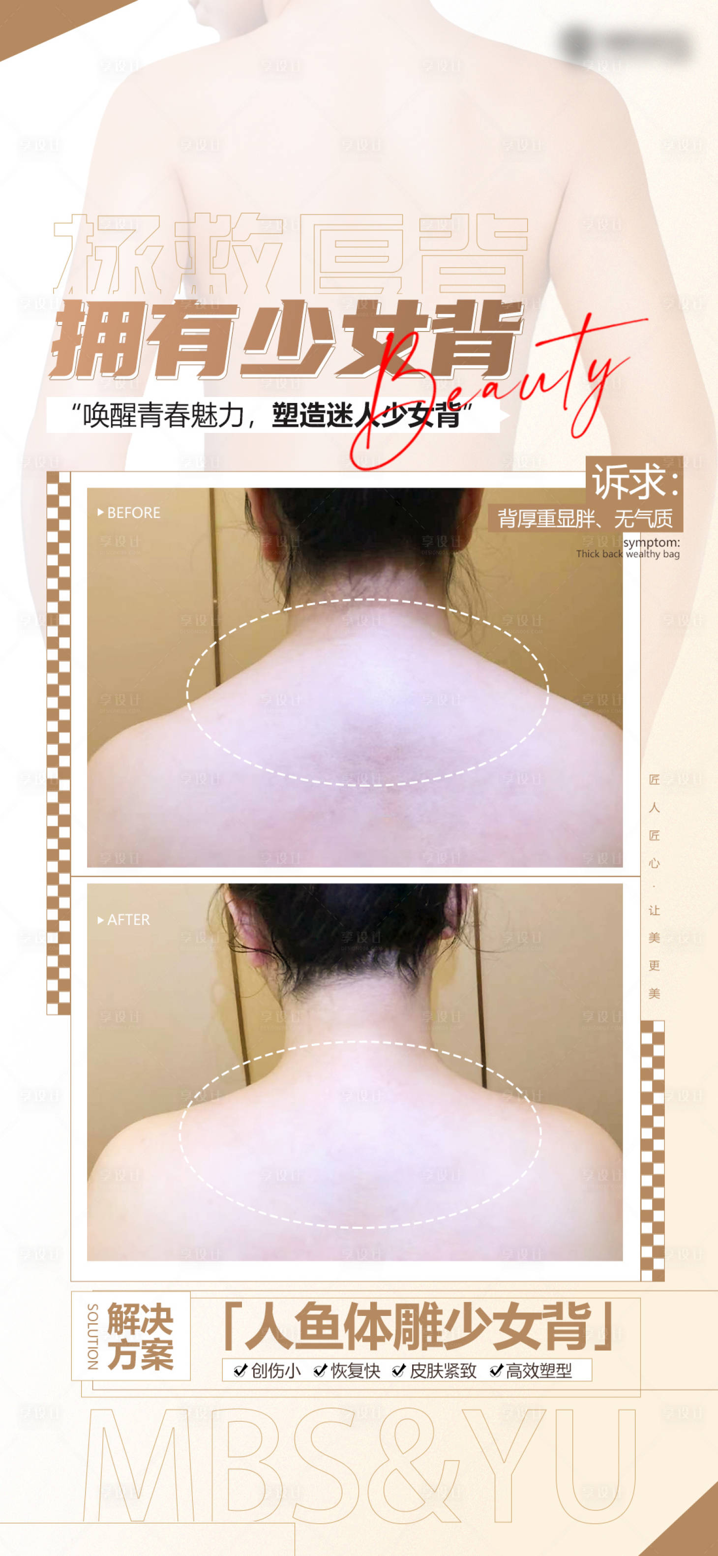 源文件下载【少女背医美海报】编号：24960025766359532