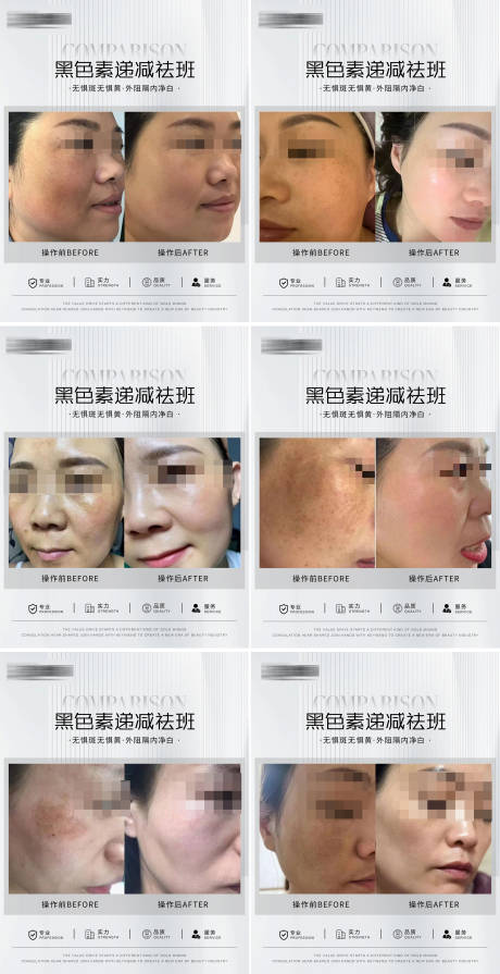 源文件下载【享设计】搜索编号：12430025952679487【淡斑案例系列海报】