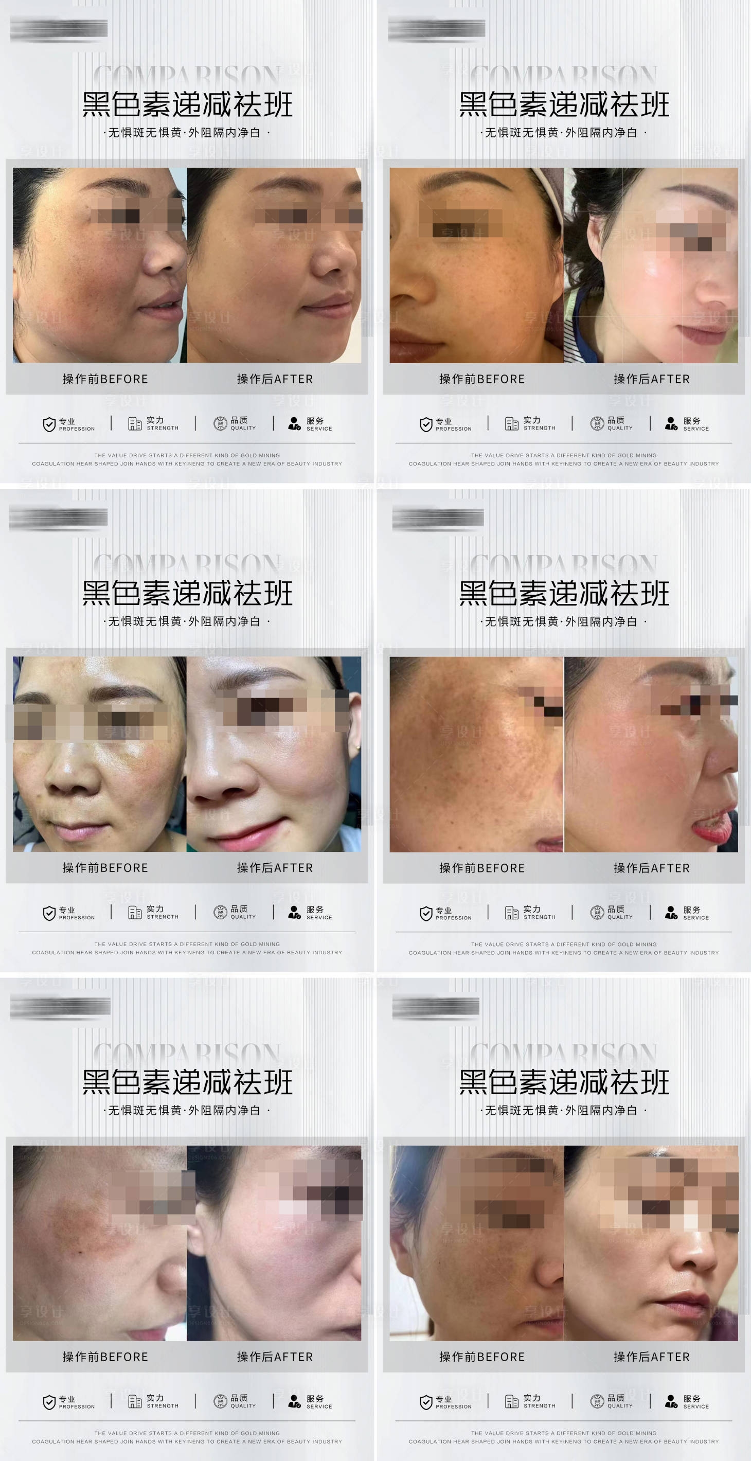 源文件下载【享设计】搜索编号：12430025952679487【淡斑案例系列海报】
