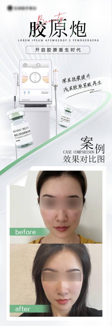 源文件下載【醫美活動長圖】編號：63640025781871706