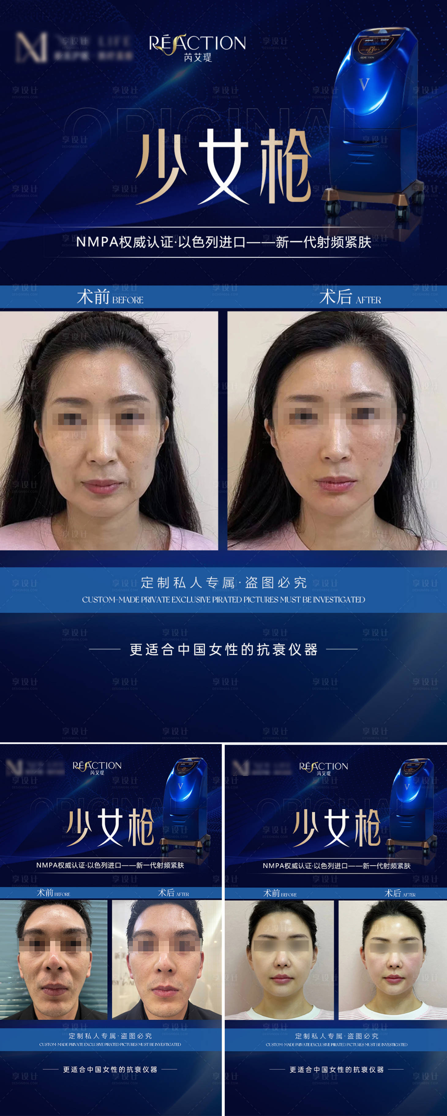源文件下载【享设计】搜索编号：20660025721255667【医美少女枪案例对比海报】