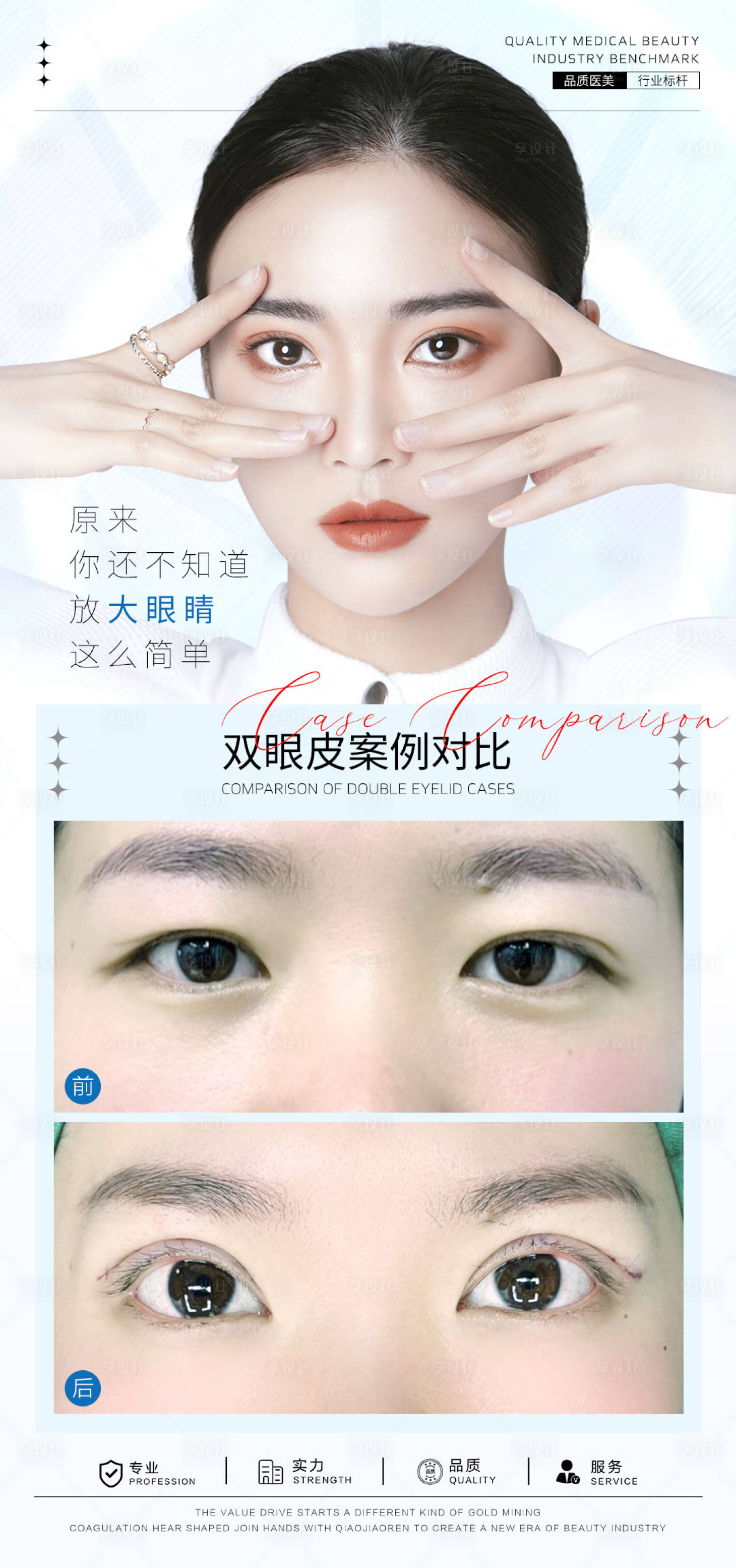 源文件下載【享設計】搜索編號：61240025868585014【雙眼皮案例海報】