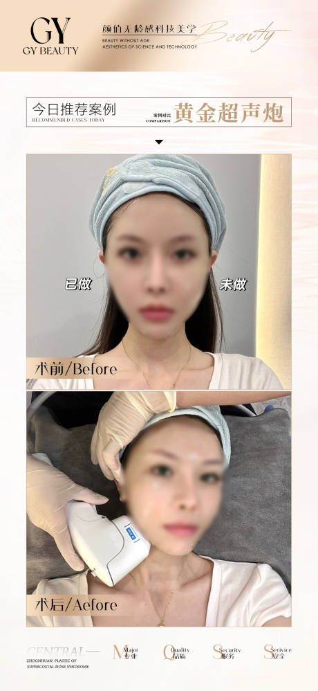 源文件下载【享设计】搜索编号：91430025914107947【医美对比案例海报】