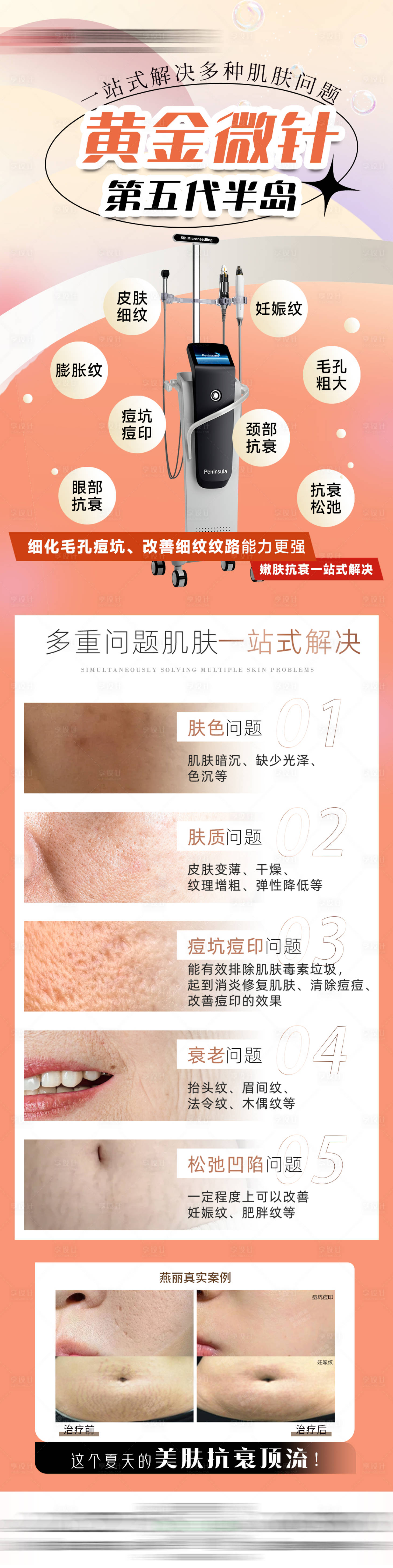 源文件下载【享设计】搜索编号：82190025637292372【医美黄金微针长图】