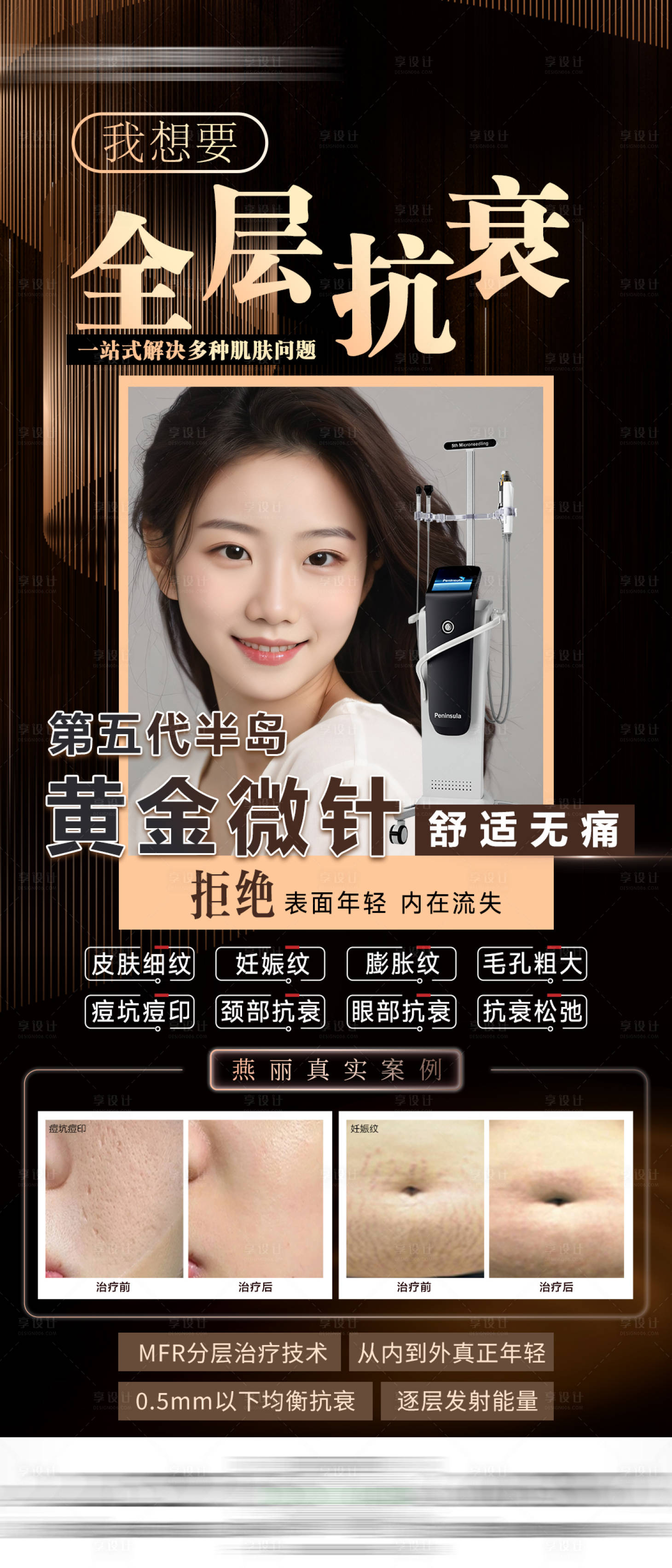 源文件下載【享設(shè)計(jì)】搜索編號：87110025637407539【醫(yī)美黃金微針】