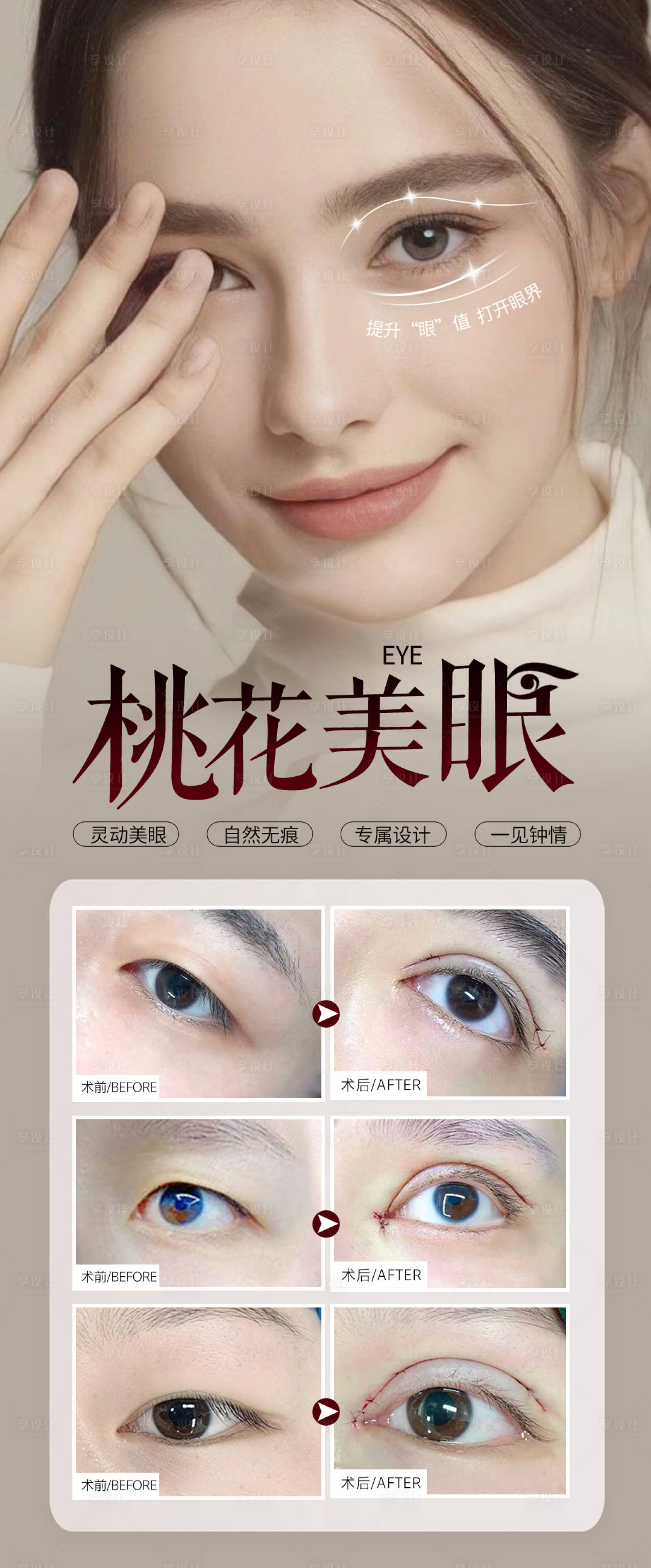 源文件下载【享设计】搜索编号：95680025884769335【双眼皮眼部案例海报】